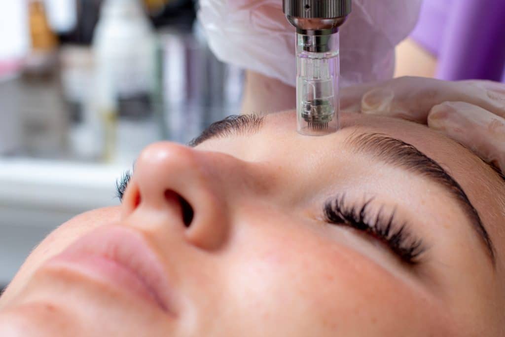 Microneedling at the Self-Care Center