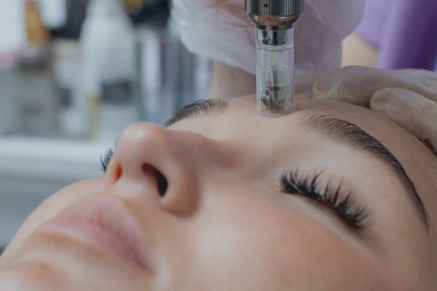 Customized facial and clinical skincare in Venice, FL